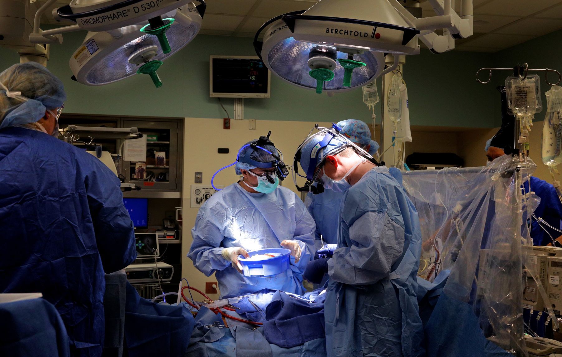 New rules governing organ transplants affect donor, recipent pool